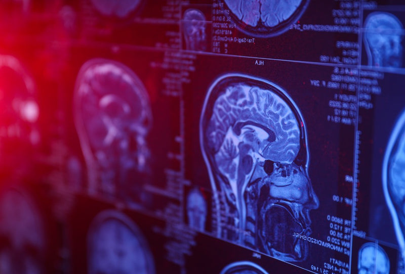 Brain injury recovery