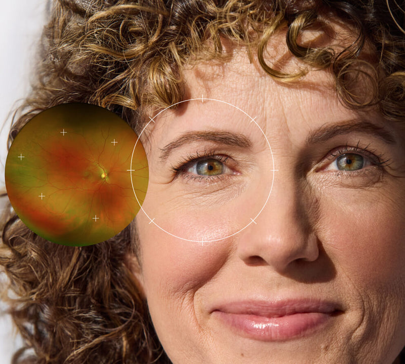 What Is an Ultra-Wide Eye Scan? | Retinal Imaging